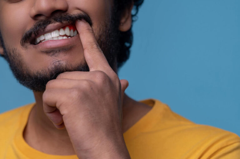 Homem aponta para gengiva sangrando com início de gengivite, buscando tratamento na GEN Odontologia em Higienópolis para o dente não cair.